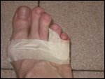 Ouch!