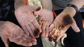 Black stains on the palms
