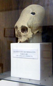 deliberately deformed skull, Uyuni museum