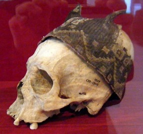 Skull in a hat