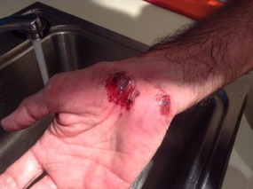 Man down! That hurts.