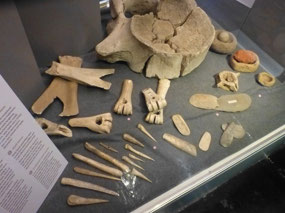 Bones